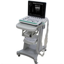 Scanner à ultrasons pour ordinateur portable avec chariot A